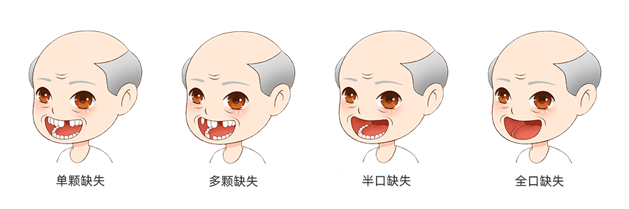 1681873661219462.png 牙缺失成员报道.png